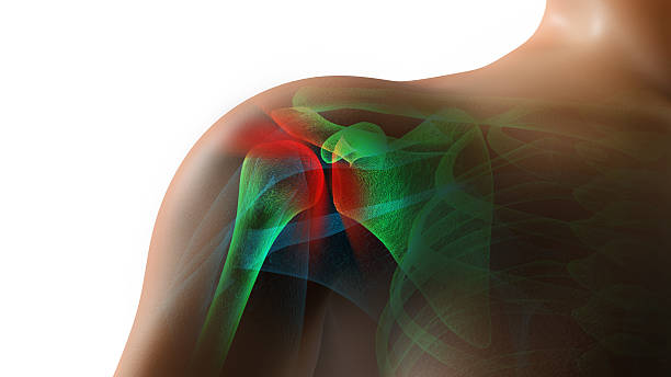 Rotator Cuff Damage Following a Car Accident