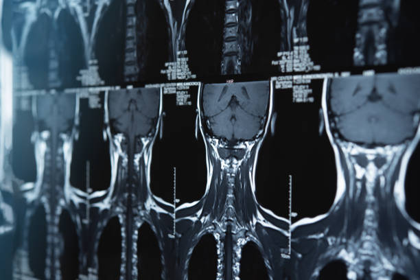 MRI in Chiropractic Practice: Its Role in Diagnosis