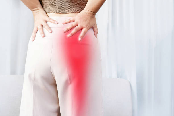 picture showing pain caused by sciatica
