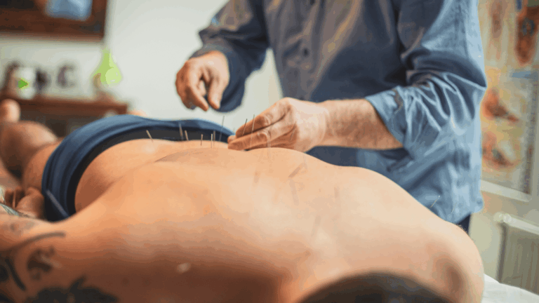 acupuncture